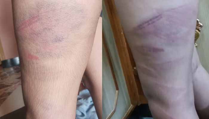 راولپنڈی: سبق یاد نہ کرنے پر نجی اسکول کے استاد کا طالب علم پر بدترین تشدد، جسم پر نشانات پڑ گئے